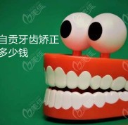 自貢矯正牙齒大概多少錢