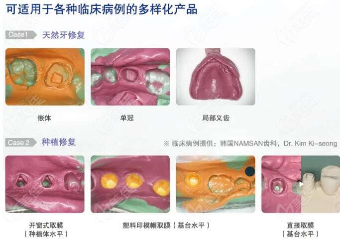 奧齒泰新品—硅橡膠彈性體口腔印模材料優(yōu)勢(shì)介紹