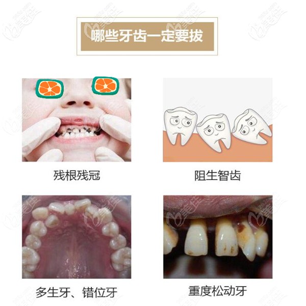 重庆牙科医院收费价目表