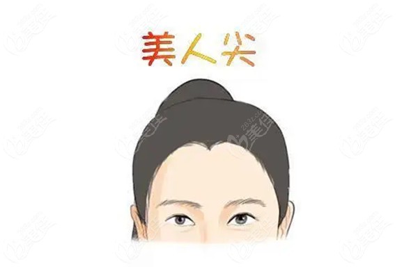 重慶種植美人尖多少錢(qián)