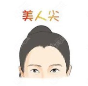 重慶種植美人尖多少錢