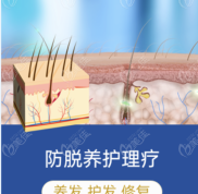 大麥微針植發(fā)的頭皮理療對脫發(fā)有效嗎
