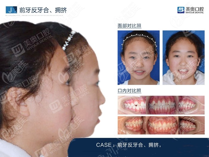 重庆儿童牙科医院排名已出
