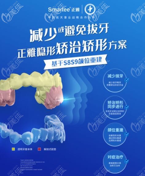 可改變凸面型的正雅GS版隱形牙套價格是多少