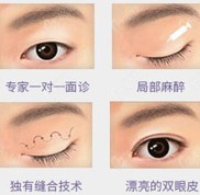 分享銀川做眼綜合的醫(yī)生誰比較好