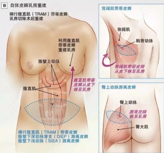 匯總?cè)榉恐亟ㄔ僭斓姆绞接袔追N