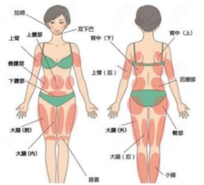 想知道維密脂雕和水動力吸脂的區(qū)別