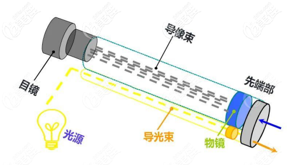 你知道软窥镜隆胸是什么吗