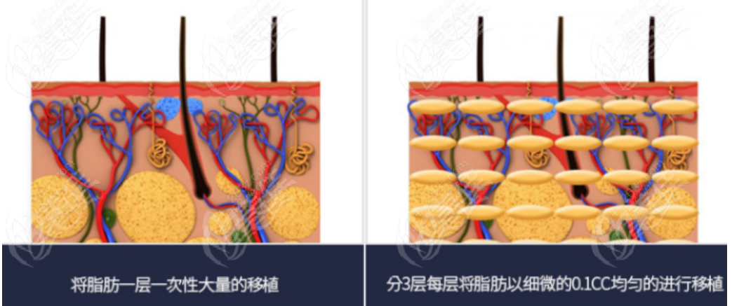 韓國歐佩拉整形醫(yī)院價格公示