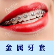 帶上我的新鄉(xiāng)牙齒矯正價(jià)格表到拜博口腔做日本TOMY陶瓷自鎖矯