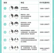 贛州去醫(yī)院看脫發(fā)需要多少錢