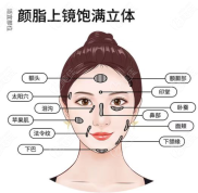 南昌做脂肪填充多少錢