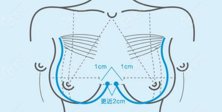 深V動感無痕豐胸是什么意思