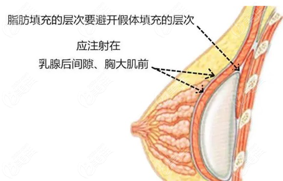 厦门欧菲和海峡哪家脂肪填充比较好