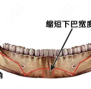 西安可以做下巴截骨手術(shù)的醫(yī)院醫(yī)生亮相