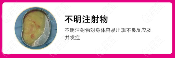 奥美定注射后的5种症状