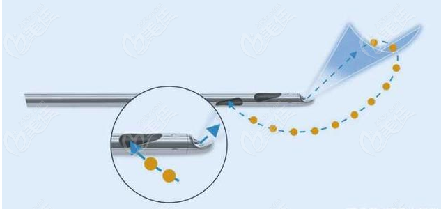 新版贵阳整形医院抽脂价格表