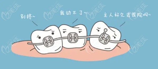 咸宁矫正牙齿大概多少钱