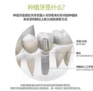 瞅瞅廊坊愛嘉口腔種植牙技術(shù)怎么樣
