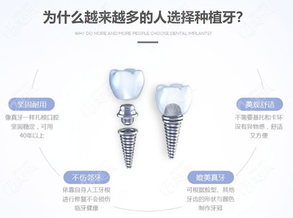 南宁蓝天口腔医院种牙技术如何