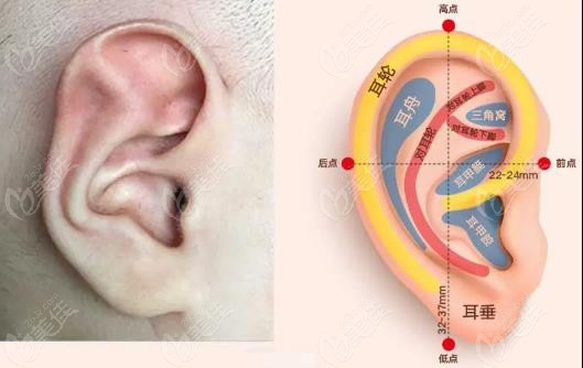 常見的新生兒耳朵先天畸形種類大全