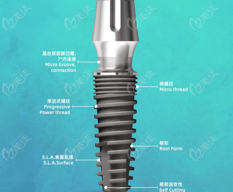 韓國沃蘭種植體的價格得多少錢