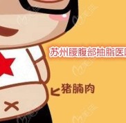 蘇州做腰腹抽脂減肥好的醫(yī)院看在蘇州腰腹部環(huán)吸的費用是多少錢