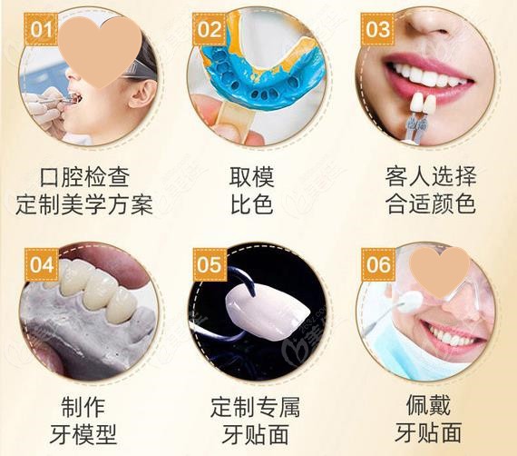 猜猜郑州牙齿贴面口腔医院排名中金水区/二七区上榜的是哪几家