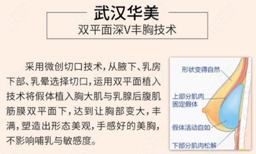 武汉隆胸厉害的医生做假体隆胸技术好价格也不贵