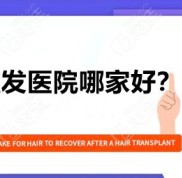 武漢植發(fā)醫(yī)院哪家技術(shù)好