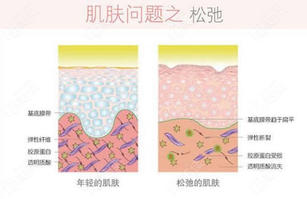 那些關(guān)于賽諾秀5D膠原光儀器的操作原理及維持時(shí)間你都知道嗎