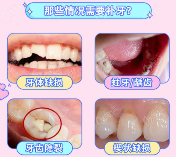 滁州牙科收费标准