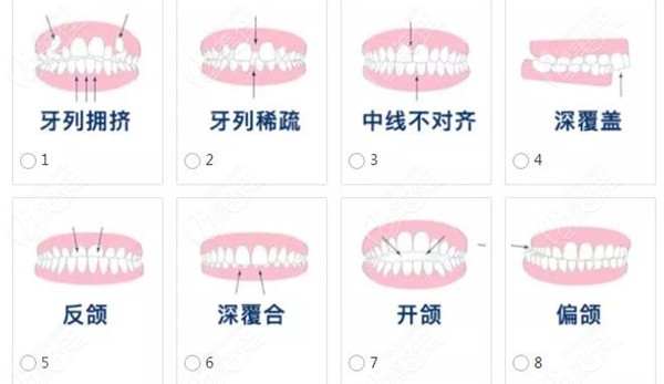 在青岛牙齿矫正价格是多少钱