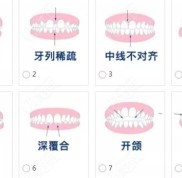 在青島牙齒矯正價格是多少錢