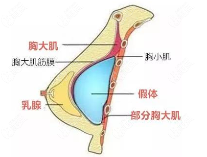 说栗勇隆胸技术靠谱