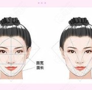 桂林做脂肪填充哪里好