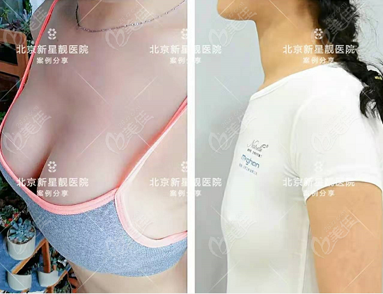 都在北京假体隆胸医生排名榜上