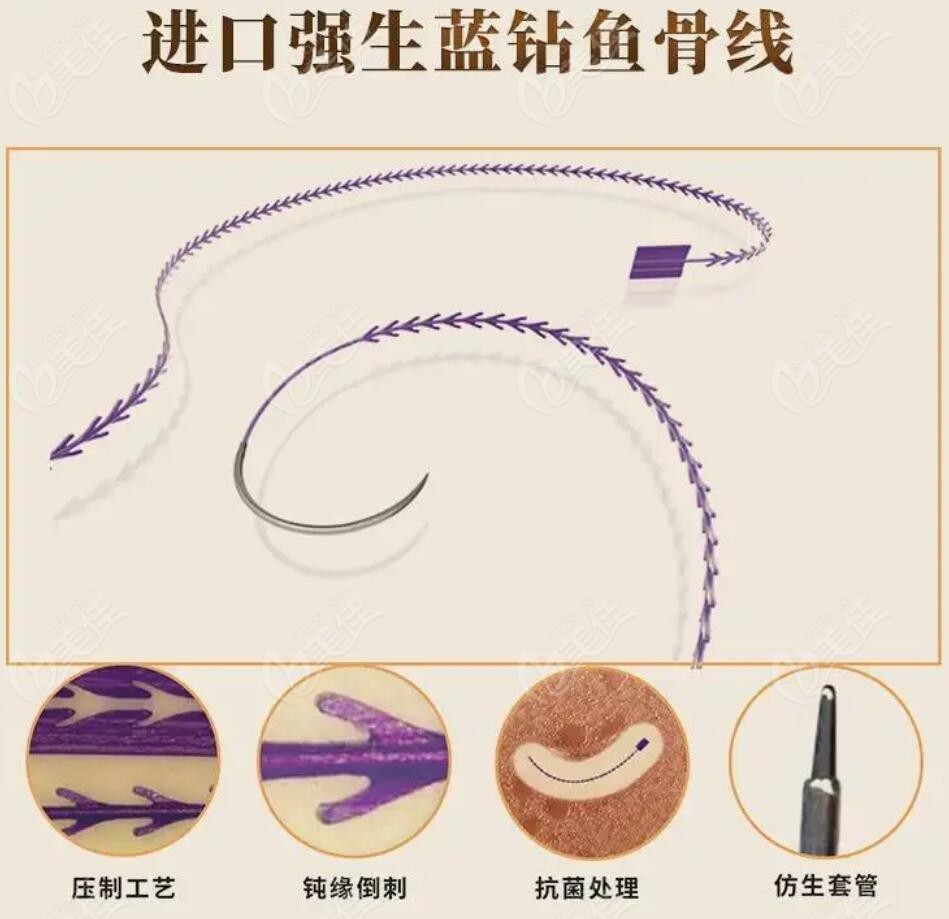 美國強(qiáng)生魚骨線提升的價(jià)格是多少錢