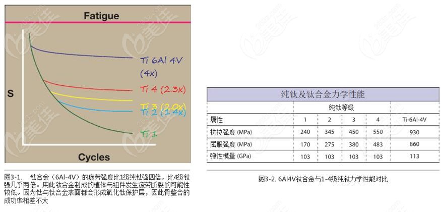 先了解美國AIDI種植系統(tǒng)的材質(zhì)和優(yōu)點(diǎn)