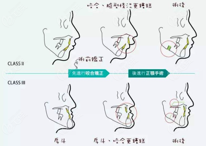 面部不對稱是什么原因造成的