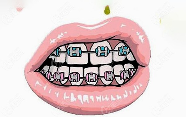 双鸭山口腔医院价格表详解洗牙、拔牙、种牙多少钱