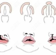 沈陽(yáng)哪家醫(yī)院做唇腭裂修復(fù)術(shù)比較好