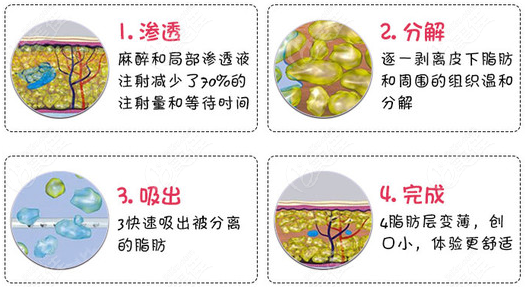 福州吸脂好的医院排名前十里面