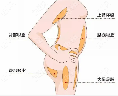 濟南諾德做吸脂手術(shù)怎么樣