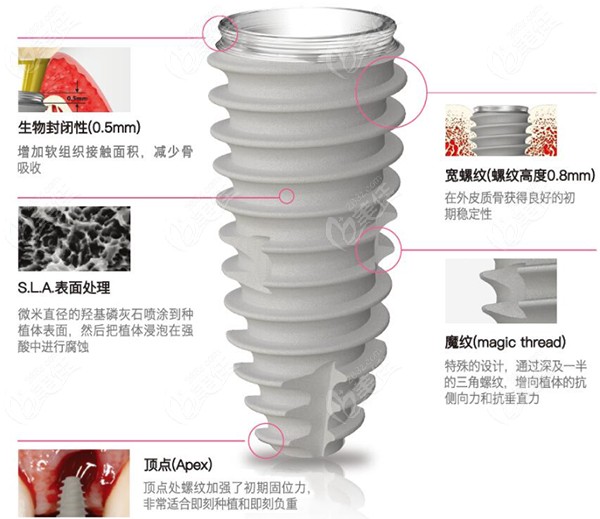 韓國(guó)Neo與登騰及奧齒康哪個(gè)好