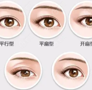 西安國際醫(yī)學(xué)院割雙眼皮多少錢