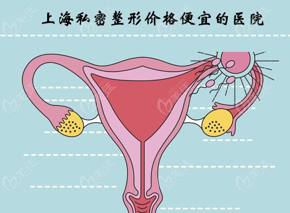 上海阴道紧缩私密修复手术费用比较便宜的医院有虹桥、名媛和美联臣等