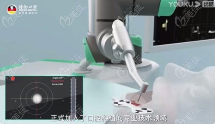 来广州广州德伦口腔体验机器人种牙