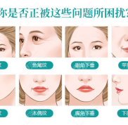 廣州可以做拉皮手術(shù)的正規(guī)醫(yī)院在此