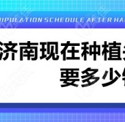 濟南現(xiàn)在種植頭發(fā)要多少錢